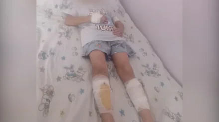 Денесін үтікпен күйдірген: анасынан зәбір көрген балалар ауруханада жатыр
