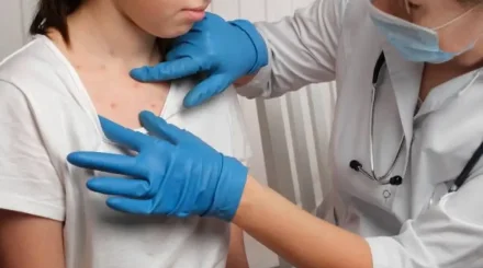 Елде қызылша өршіп тұр: ең көп жағдай тіркелген өңірлер белгілі болды