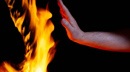   Алматыдағы дәрігерлер денесінің 89 пайызы күйген науқасты аман алып қалды   