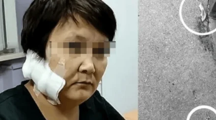  «Алты баланың анасы»: Шығыс Қазақстан тұрғыны бұрынғы әйелінің құлағын кесіп алған 
