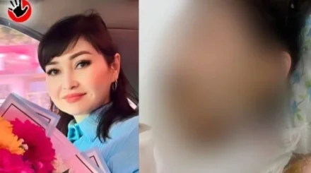 Шымкентте ер адам бұрынғы әйеліне қышқыл төгіп, қашып кеткен