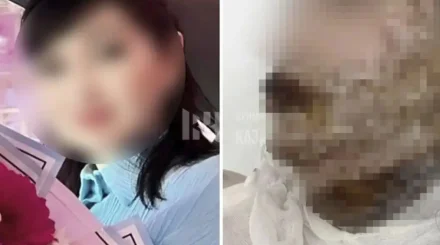  Шымкент тұрғыны бұрынғы әйелінің бетіне қышқыл шашып жіберген 