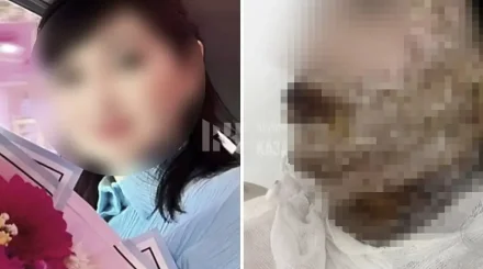 «Мен сені адам танымастай қылып тастаймын»: Бұрынғы әйелінің бетіне қышқыл шашқан күдікті ұсталды
