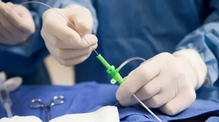 Қызылорда облысында отадан кейін науқастың денесінде дәке қалып кеткен: сот медициналық мекемені кінәлі деп таныды