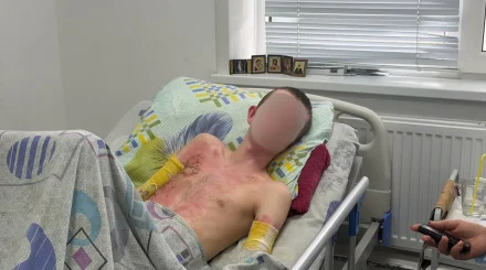 В Костанае подросток получил удар током в 27 тысяч вольт ради фото на вагоне