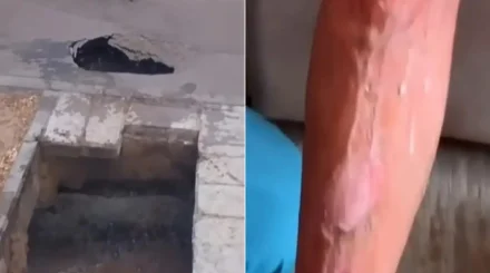 Павлодарда қайнаған су толы шұңқырға құлаған ер адамға өтемақы төленді