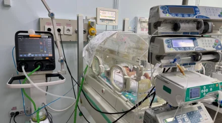 Дәрігерлер 740 грамм салмақпен дүниеге келген сәбидің өмірі үшін 80 күн күресті