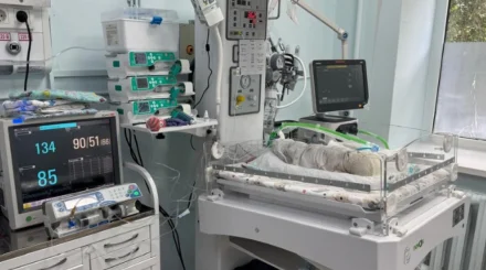  Алматыда дәрігерлер 740 грамм болып туған сәбидің өмірі үшін 80 күн күресті 