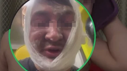 Повар получил ожоги после вспышки газа на кухне в заведении Астаны