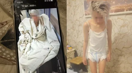 Сломал позвоночник на фоне ревности: 22-летняя алматинка почти год добивается справедливости