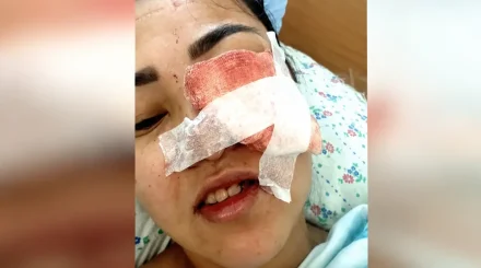 «Балалы бола алмаймын»: Ақтөбеде тіс емдеткен әйел емхананы сотқа берді