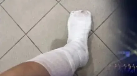 «Нас затоптали»: зрители показали травмы после концерта Кайрата Нуртаса