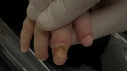  Жаңаөзенде жеті айлық сәби желдеткіштен ауыр жарақат алды 