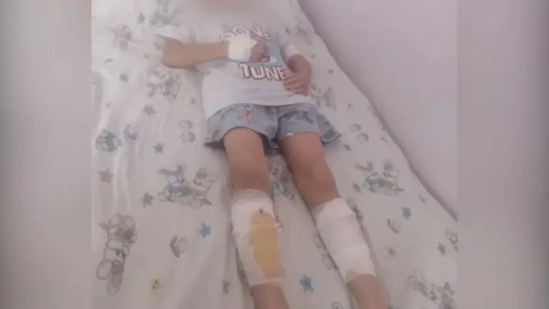 Денесін үтікпен күйдірген: анасынан зәбір көрген балалар ауруханада жатыр