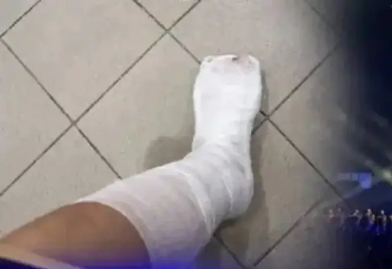 «Нас затоптали»: зрители показали травмы после концерта Кайрата Нуртаса