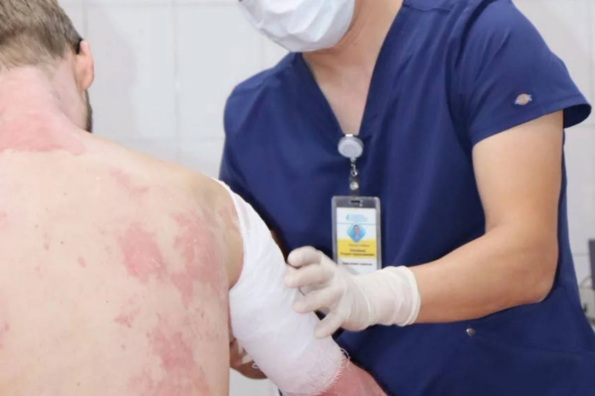 Врачи спасли пациента с ожогами 90% тела после взрыва газового баллона в Алматы