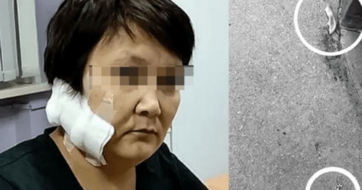  «Алты баланың анасы»: Шығыс Қазақстан тұрғыны бұрынғы әйелінің құлағын кесіп алған 
