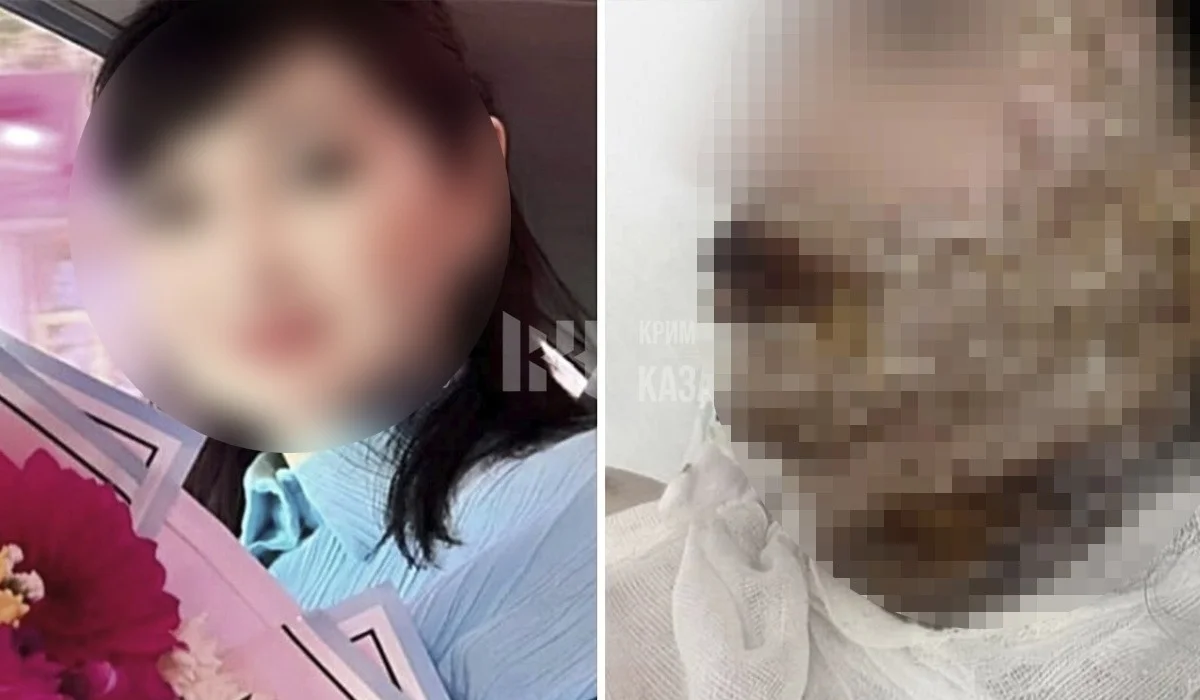 Шымкентте ер адам экс-жұбайының бетіне қышқыл шашқан: әйел ауыр жарақат алды