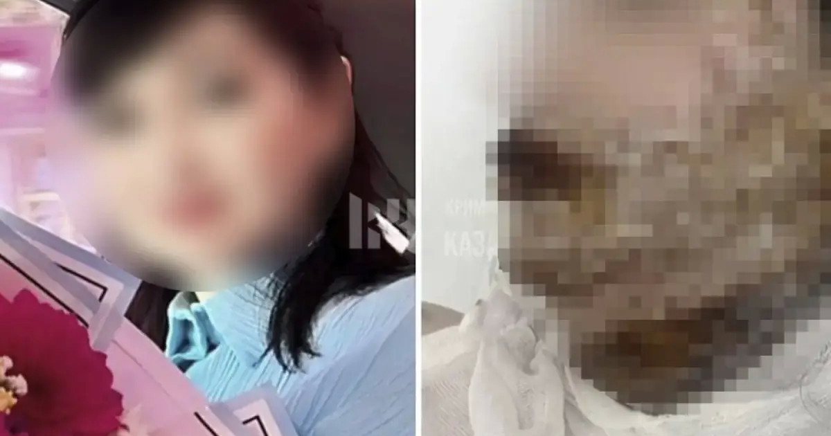  Шымкент тұрғыны бұрынғы әйелінің бетіне қышқыл шашып жіберген 